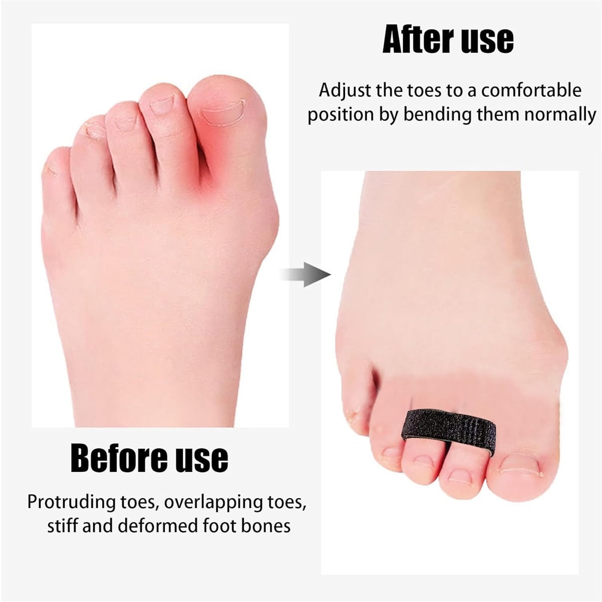 Hook and Loop Finger Wrap