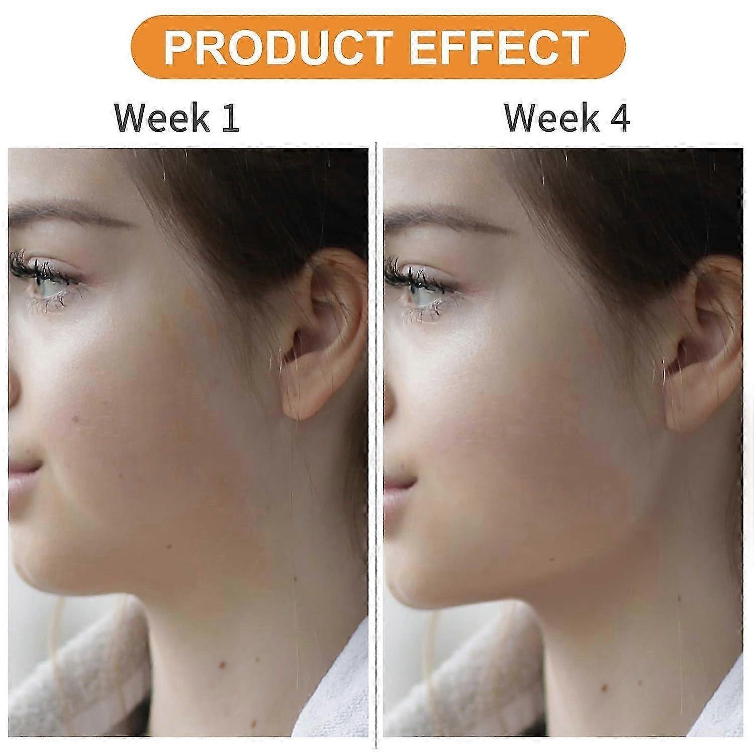 Jaw Exerciser